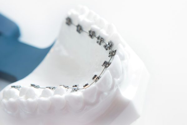 AdobeStock_303900704